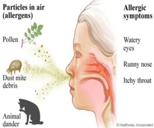 this image illustrates causes of allergies and how they might affect you